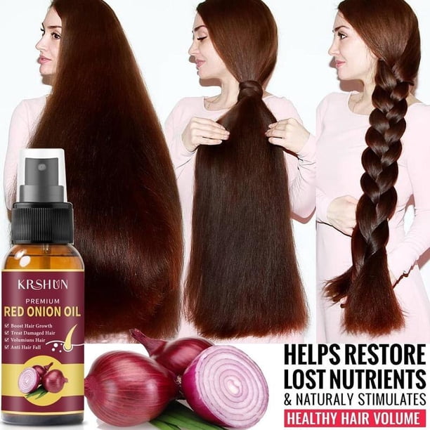 Aceite para el cabello de semillas negras de cebolla, Spray para el cuidado y crecimiento del cabello Natural, previene la caída del cabello, biotina, crecimiento rápido del cabello