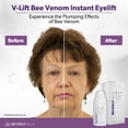 thumbnail image 4 of Sérum Eye Lift y Eye Tuck Beverly Hills V-Lift 30 ml, 4 of 8