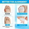 thumbnail image 4 of Metatarsal Pads,Toe Separator, Gel Metatarsal Cushion Toe Separators, (4 PCS WHITE) New Material Forefoot Pads, Toe Spacers,Breathable & Soft Gel, Best for Diabetic Feet, Blisters, Forefoot Pain., 4 of 6