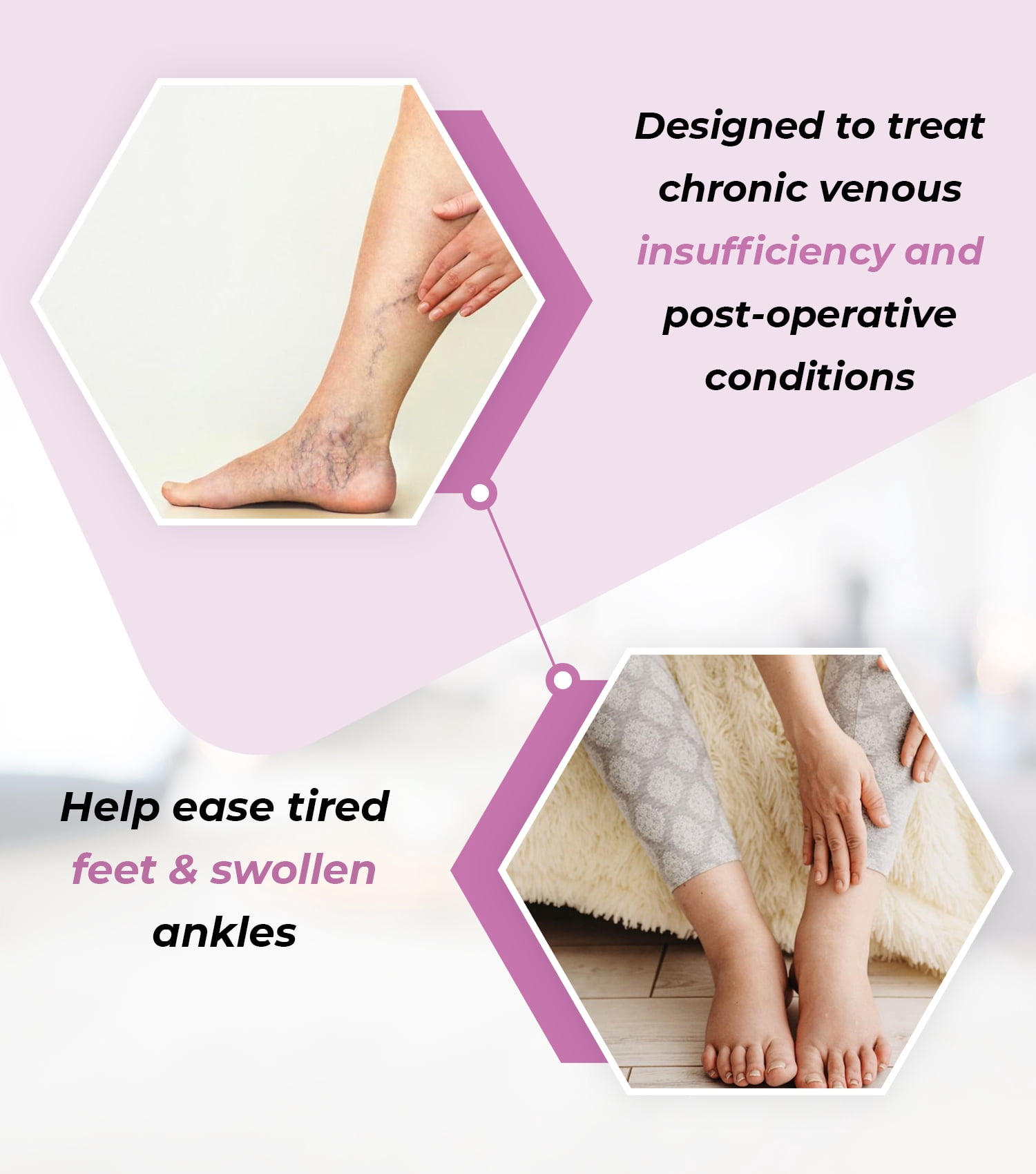 ITA-MED Unisex Microfiber Open Toe Knee High Graduated Compression Stockings (25-35mmHg): H-304(O)