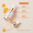 thumbnail image 3 of ANAiRUi Squalane + Vitamin E Rosehip Oil Moisturizer for Face Hydrate, Reduce Scars and Stretch Marks, Wrinkles for Smoother, Softer Skin 1 fl. Oz, 3 of 10