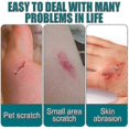 thumbnail image 4 of 3pcs New Skin Liquid Plaster, Waterproof And Breathable Quick-dry Gel Liquid Bandages For Scrapes/cracked Skin/wounds/dry_lucky_b, 4 of 5