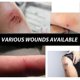 thumbnail image 5 of Waterproof Transparent Adhesive Bandage Bathing Swimming Transdermal Patch Water, 5 of 5