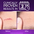 thumbnail image 3 of Scar Gel Cicatricure Advanced 28g for Face & Body, 3 of 8