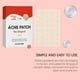 thumbnail image 4 of Promotional activities!Acne Patch Cloud Shape Hydrocolloid Acne Patch Acne Absorption Patch Facial Skin Care Cover Patch (1 Pack, 36 Tablets), 4 of 8