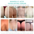 thumbnail image 3 of Serum Almond Clear Body Clear para el acné de nivel 2, 120 ml, 3 of 8
