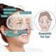 thumbnail image 2 of Dispositivo para mejorar la visión Ophthalpro, alivia la fatiga ocular, reduce la fatiga y promueve la relajación (modelo recargable), 2 of 5