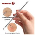 thumbnail image 3 of Blackhead Extractor, [5 Piece] Professional Blackhead Tweezer Extractor Kit, Stainless Steel Blackhead Remover for Removing Comedones, Pimples and Pustules, 3 of 6