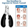 thumbnail image 2 of For Thick Nails ,professional Nail Clipper, 2 of 5
