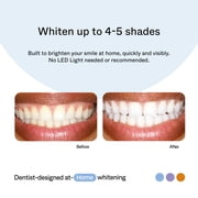 Opalescence Home Advanced Gel Prefill Teeth Whitening Trays 15% (4 Treatments) Hydrogen Peroxide PF