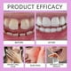 thumbnail image 2 of New Jeretis Thermo Denture ,jeretis Denture-Yogu, 2 of 5