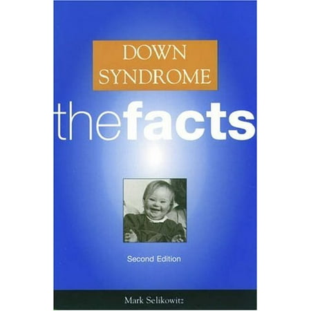 Down Syndrome: the Facts [Paperback - Used]