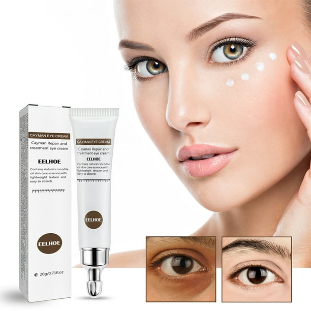 Crema para los ojos Reduce las ojeras Bolsas para los ojos Crema hidratante para los ojos Crema hidratante para los ojos