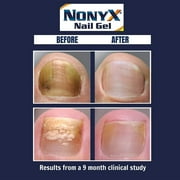 NonyX Nail Gel 4 Oz