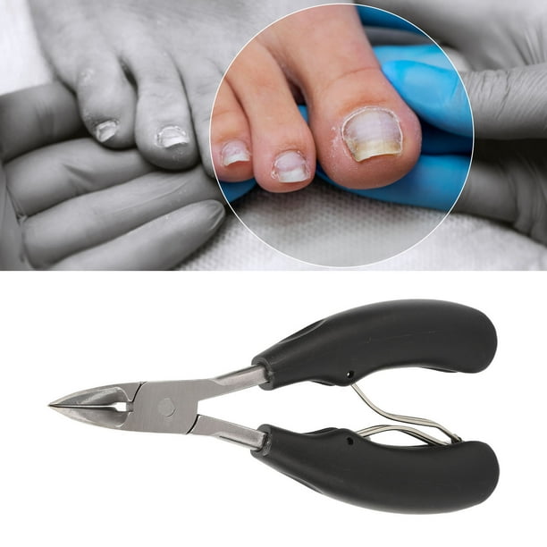 Cortaúñas De Pies Herraienta De Uñas Encarnadas Para El Trataiento De