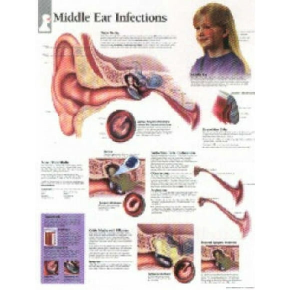 Publishing, S: Middle Ear Infections Paper Poster
