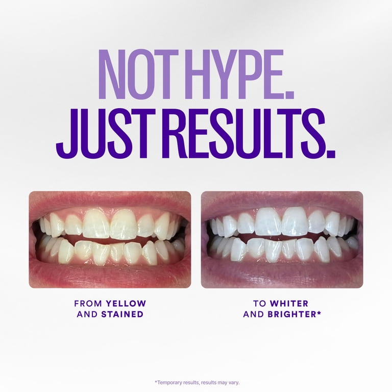 Hismile V34 Whitening Strips, Teeth Whitening Strips, Purple