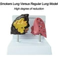 thumbnail image 2 of Smokers Lung Model, Healthy Lung Model Life Size Human Lung Anatomy Model with Pathological Features, 2 of 8