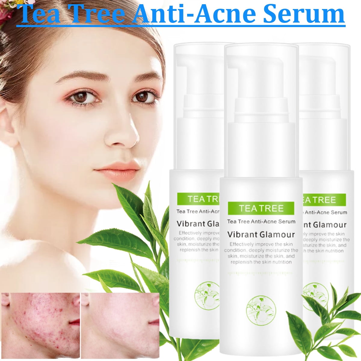 6x Tea Tree Anti Acne Serum Acne Scar Treatment Print Anti Wrinkle Pores Essence Walmart Canada