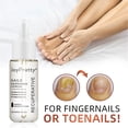 thumbnail image 4 of Suero para el cuidado de las uñas con hongos, loción de esencia para reparación de uñas gruesas y suaves, tratamiento blanqueador de dedos de los pies, 4 of 5