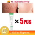 thumbnail image 1 of Crema retráctil de poros con ácido salicílico, eliminación rápida de poros grandes, eliminación de puntos negros, estiramiento de la cara, piel suave, producto coreano para el cuidado, 1 of 5