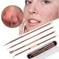 thumbnail image 2 of Apuakthei - Juego de 4 herramientas extractoras de espinillas y comedones para acné, tratamiento para imperfecciones, estallidos blancos, eliminación de granos para la piel de la nariz y la cara sin, 2 of 7