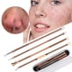 thumbnail image 2 of Apuakthei - Kit de 4 extractores de espinillas y comedones para eliminar el acné, tratamiento para eliminar imperfecciones, puntos blancos y granos para una piel libre de riesgos en la nariz y el, 2 of 7