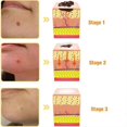 thumbnail image 4 of 2025 1pcs Tag Recede Bee Venom, Tag Recede Bee Venom Treatment Spray Tag Recede Bee Venom, 4 of 5