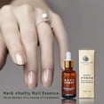 thumbnail image 4 of 1pcs 30ml Fungal Effective Nail Gel Toe Treatment Herbs Essence Oil Feet Care Nail, 4 of 4
