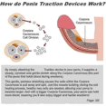 thumbnail image 3 of Upgraded Quad Craddle Support for Extender Traction Device Traction Devices for Men 5946, 3 of 3