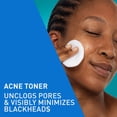 thumbnail image 5 of CeraVe BHA Exfoliating Facial Toner 2% Salicylic Acid Acne Treatment 8 fl oz, 5 of 11