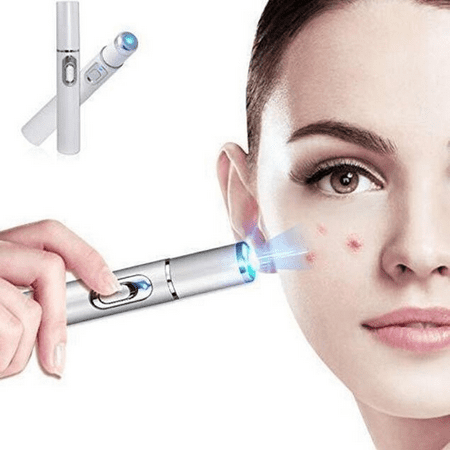 Medical Blue Light Therapy Laser Treatment Pen Acne Scar Wrinkle Removal Tool HOT