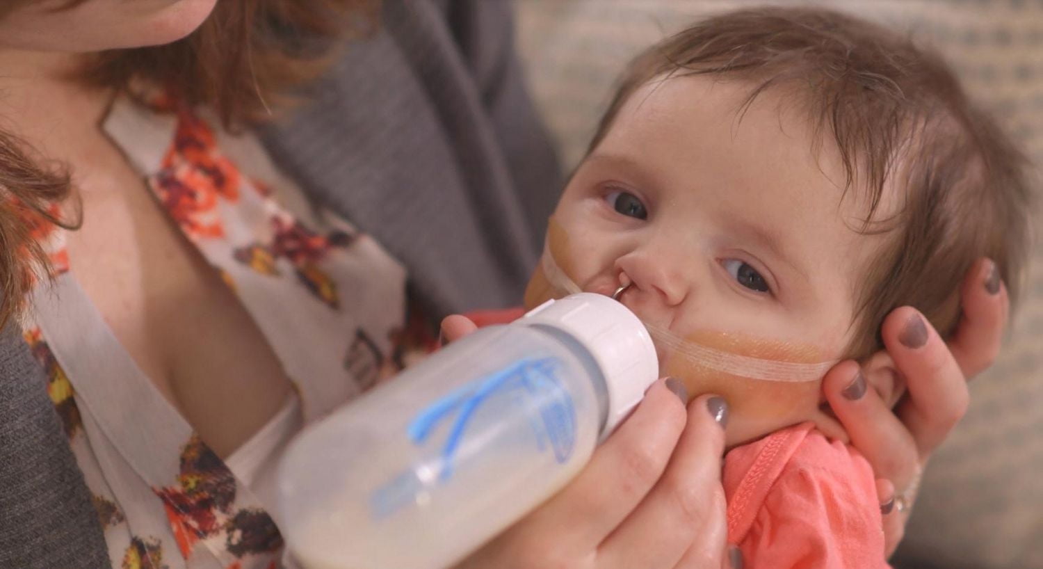 Dr. Brown's Natural Flow Specialty Feeding System with Anti-Colic Baby Bottle and Infant Paced Feeding Valve Starter Kit, 4oz and 8oz