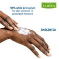 thumbnail image 2 of Medline Remedy Essentials Unscented Ointment (2 oz Tube), 12 Count, Moisturizing Barrier with Aloe, 2 of 6