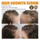 thumbnail image 3 of Natural Hair Growth Serum for Stronger Thicker Longer Regrowth Prevent Hair Loss Treatment for Women, 3 of 5
