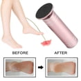 thumbnail image 4 of Electric Foot Grinding Machine, Dead Skin Callus Removal with Replaceable Grinding Piece. 360 Degree Rotation, Ergonomic Design. Compact, Portable for Travel. Low, 4 of 8