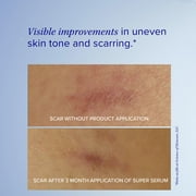 iS CLINICAL Super Serum Advance+, Anti-Aging Vitamin C Face Serum, reduces scaring and fine stretch marks, 0.5 Fl Oz