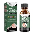 thumbnail image 1 of Tratamiento seguro para hongos en las uñas de los pies solución de reparación de uñas reparación de tiña 30ml/50ml, 1 of 9