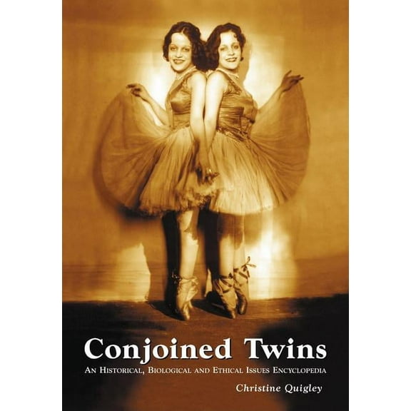 Conjoined Twins: An Historical, Biological and Ethical Issues Encyclopedia, (Paperback)