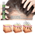 thumbnail image 3 of Hair Anti-fall Spray Anti-hair Loss Ha, 3 of 3