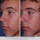 thumbnail image 3 of Limpiador espumoso para el acné Obagi ClenziDerm M.D. Daily Care, 3 of 9