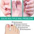 thumbnail image 3 of Kerassentials Toenail Fungus Treatment Oil - Supports Strong, Healthy Natural Nails--, 3 of 5