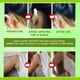 thumbnail image 2 of 10 Uds. Almohadilla Herbal para el cuidado de la linfa, pegatina antihinchazón para el cuello, almohadilla para el cuidado de la linfa de yeso para los ganglios linfáticos del pecho, 2 of 8