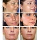 thumbnail image 4 of Repara las manchas oscuras faciales Mejora rápidamente el rostro en 28 días Hidrata y protege la piel de forma inofensiva-niubi, 4 of 5