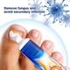 thumbnail image 5 of 20g Crema para hongos en las uñas Removedor de hongos en las uñas Crema removedora de hongos en las uñas de los pies, 5 of 5