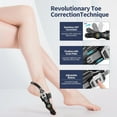 thumbnail image 4 of Bunion Corrector for Women & Men Big Toe, Black Adjustable Orthopedic Bunions Correction with Non Slip Toe Straighteners, Bunion Splint Suitable for Day/Night Feet Bunion Relief (2PCS), 4 of 7