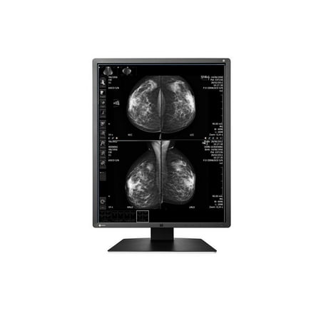 New Eizo Radiforce GX550 5MP LED Digital Monochrome Mammography Diagnostic Monitor