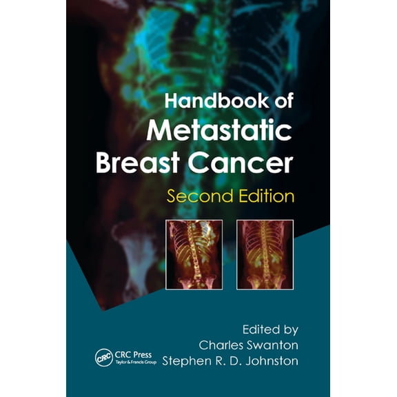 Handbook of Metastatic Breast Cancer, (Paperback)
