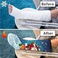 thumbnail image 7 of COEQINE Christmas 2 PCS Leg Cast Covers Santa Claus Outdoor Protection Leg Cover Stylish Cast Socks Cover Removable Leg Cast Sock Cover Below The Knee Leg Cast Sleeve for Teens Medium, 7 of 7
