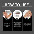 thumbnail image 3 of ExquisiteVaricose Relief Cream, Anti-Varicose Cream Varicose Veins, Anti-Varicose Soothing Cream, Varicose Relief Massage Cream For Legs, Capillary, 3 of 5